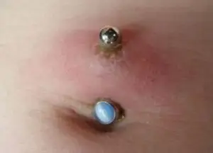 body_infected_piercing